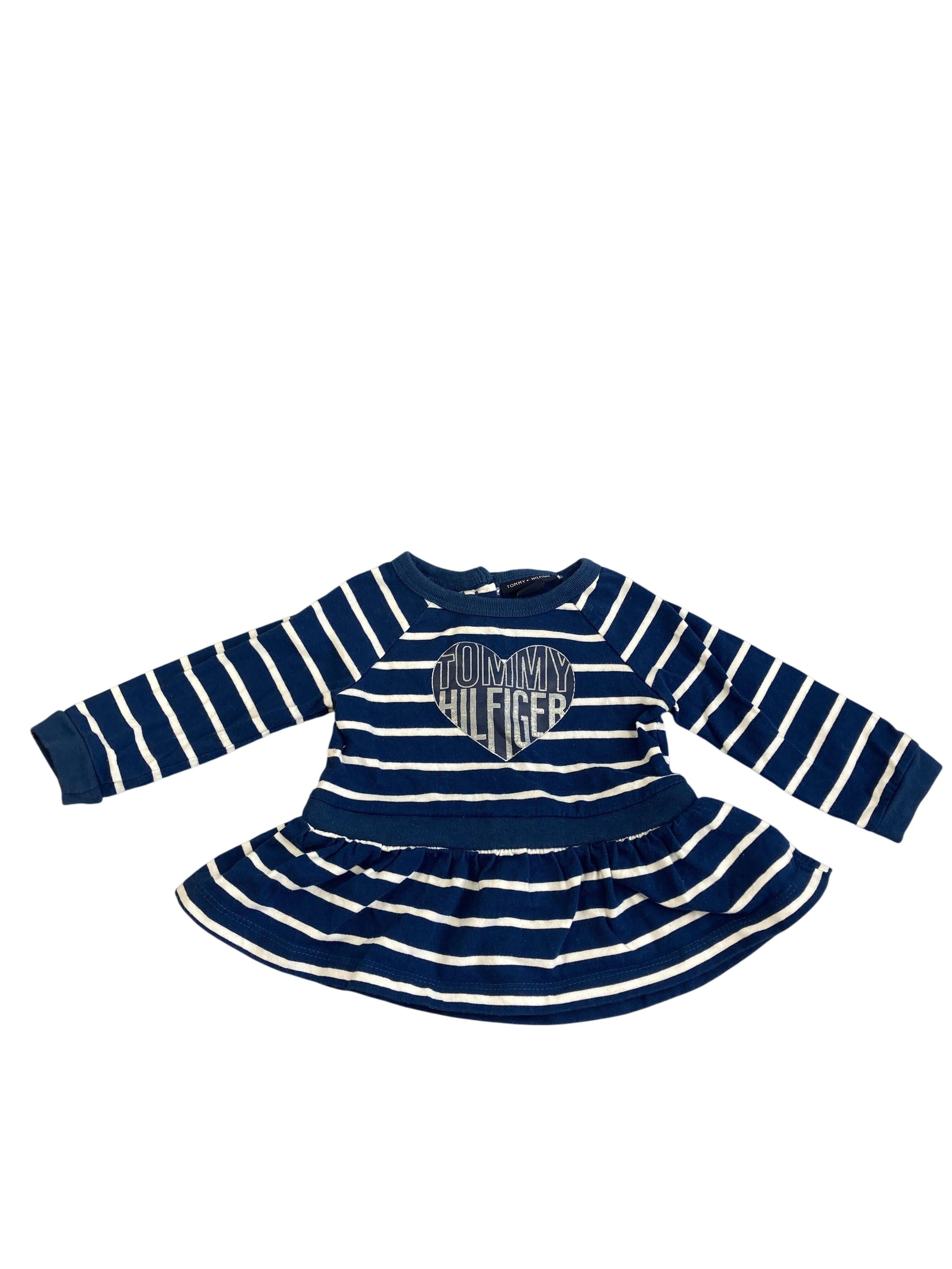 Kleider Kleider & Röcke Kleidung Kleid Tommy Hilfiger Front Image Second Hand